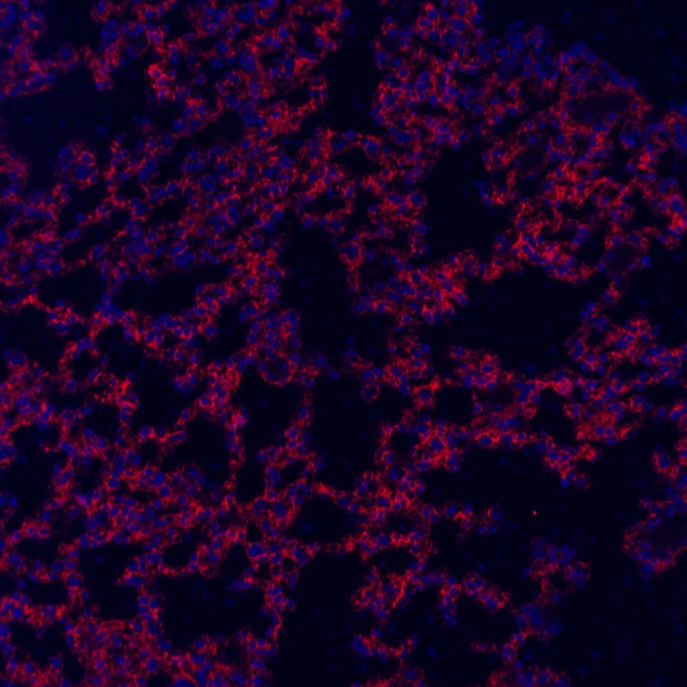 Immunofluorescence analysis of paraffin-embedded mouse lung  using CD54 Polyclonal Antibody at dilution of 1:300.