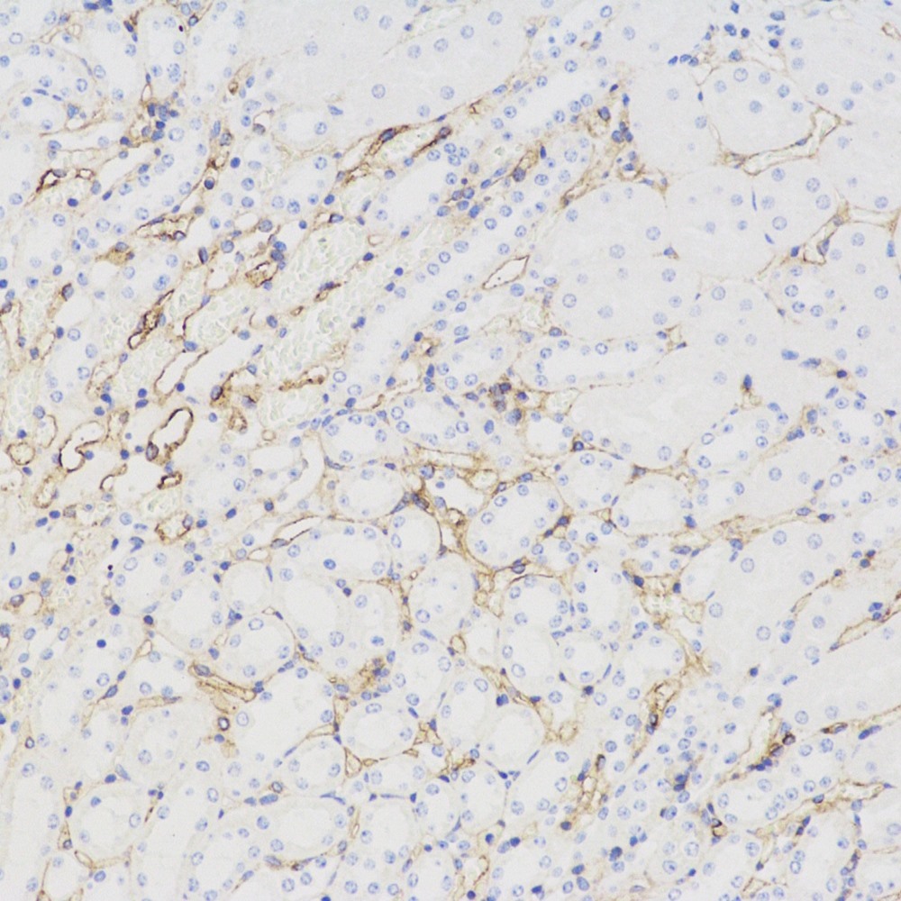 Immunohistochemistry analysis of paraffin-embedded mouse kidney  using CD54 Polyclonal Antibody at dilution of 1:500.