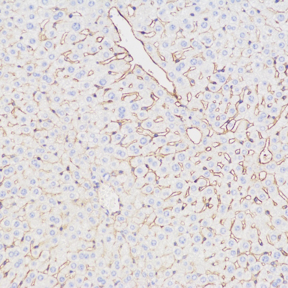 Immunohistochemistry analysis of paraffin-embedded Mouse liver  using CD54 Polyclonal Antibody at dilution of 1:500.