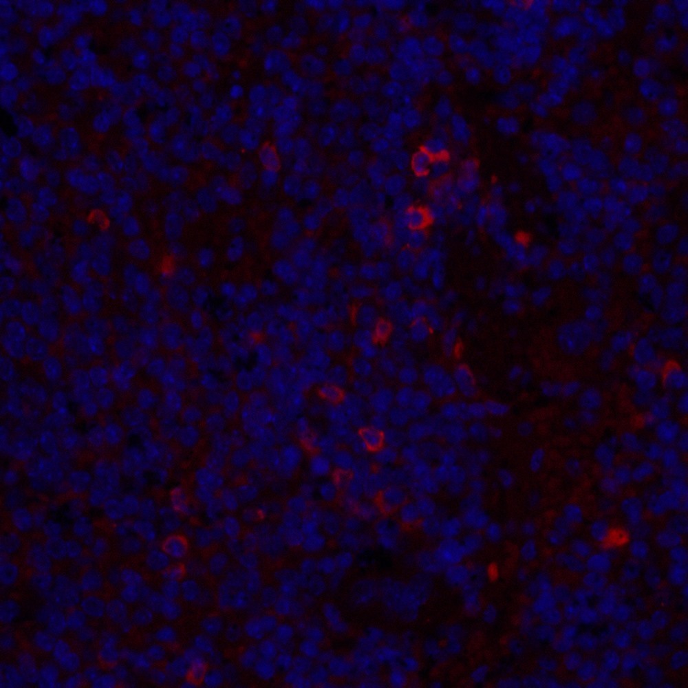 Immunofluorescence analysis of paraffin-embedded mouse inflammatory spleen  using IL2 Polyclonal Antibody at dilution of 1:300.