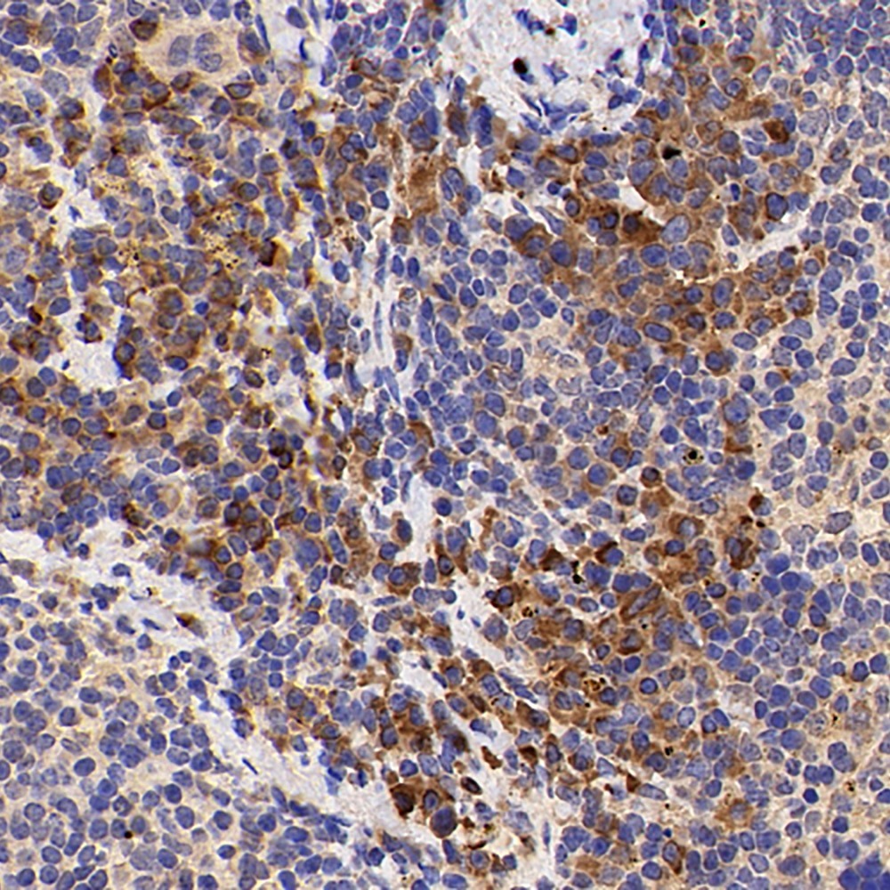 Immunohistochemistry analysis of paraffin-embedded mouse inflammatory spleen  using IL2 Polyclonal Antibody at dilution of 1:500.