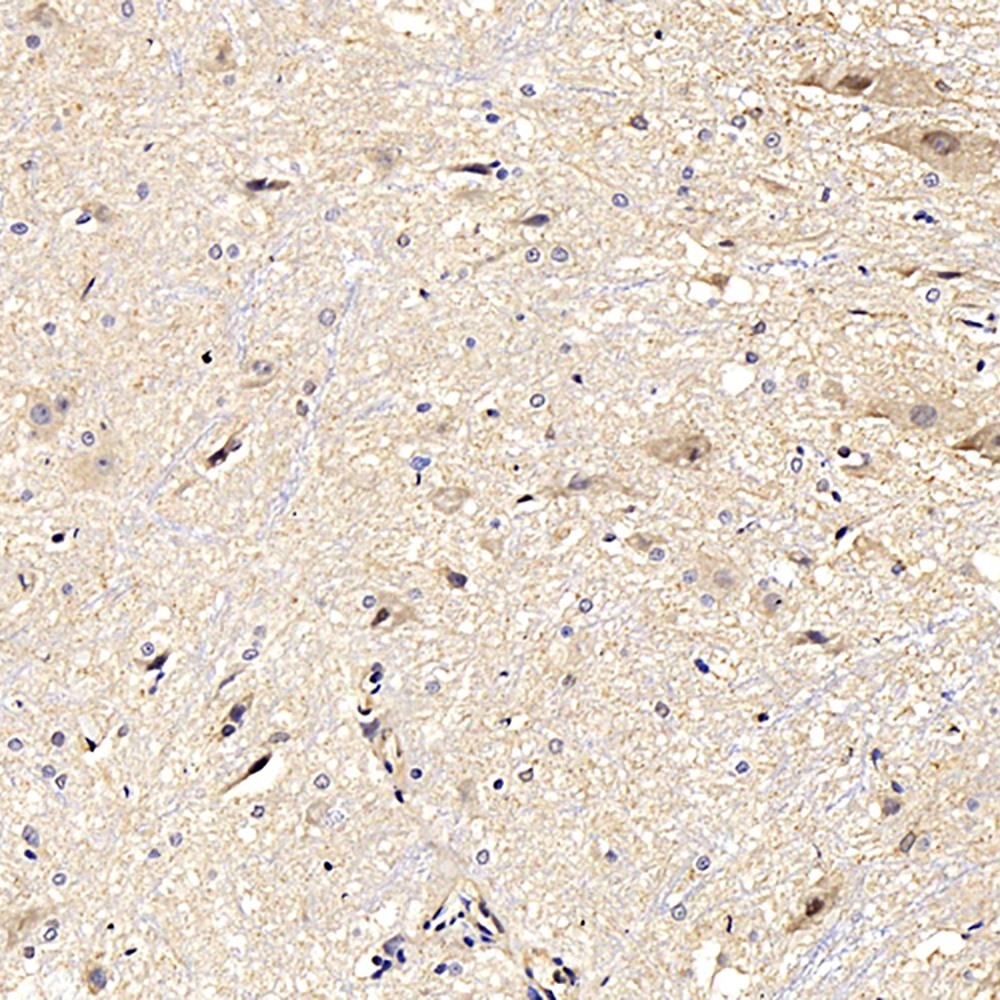 Immunohistochemistry analysis of paraffin-embedded rat spinal marrow  using NOS2 Polyclonal Antibody at dilution of 1:500.