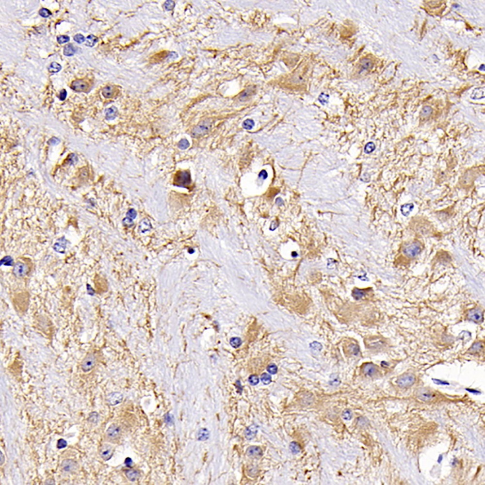 Immunohistochemistry analysis of paraffin-embedded mouse brain  using MAP2 Polyclonal Antibody at dilution of 1:300.