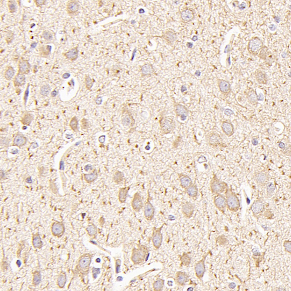 Immunohistochemistry analysis of paraffin-embedded rat brain  using MAP2 Polyclonal Antibody at dilution of 1:500.