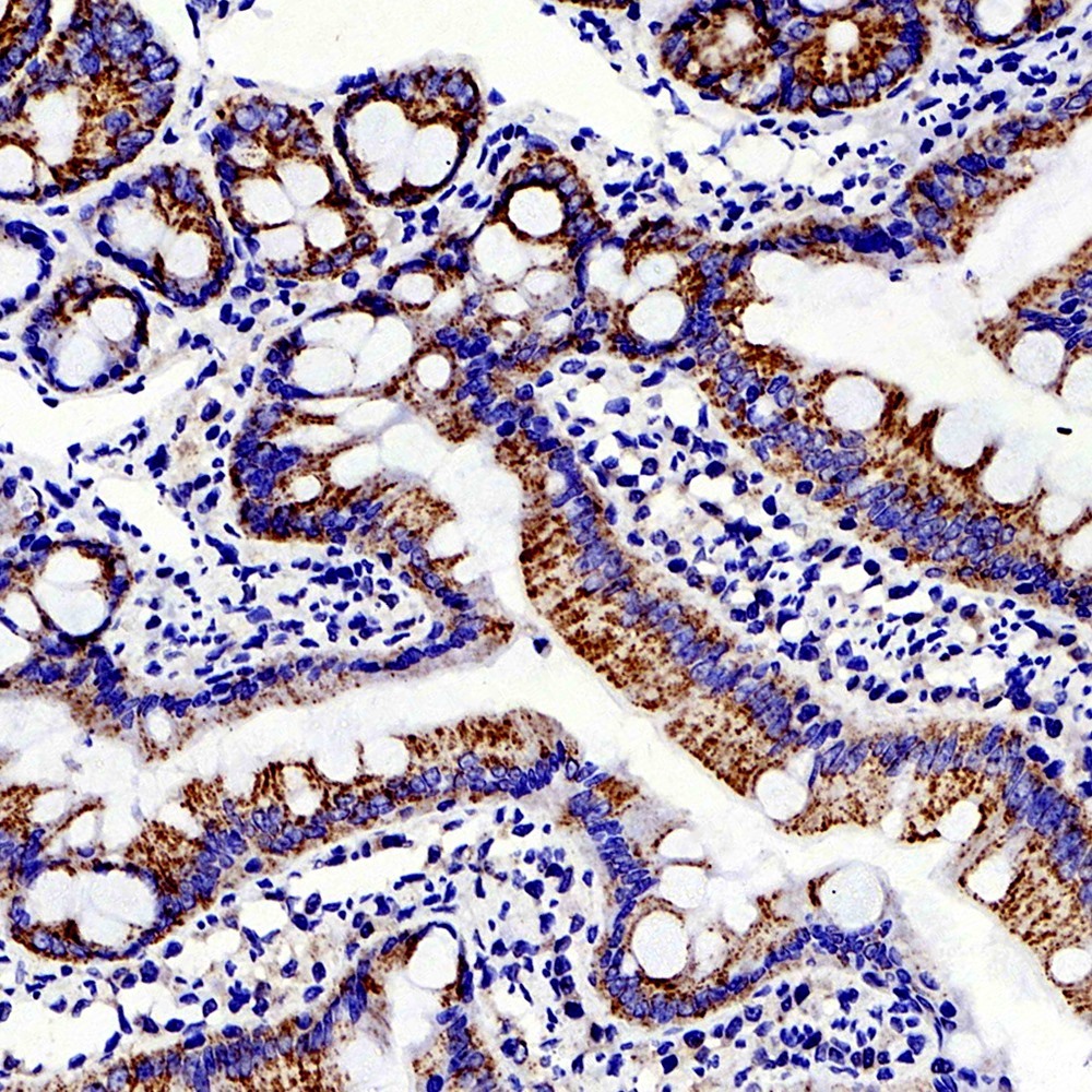 Immunohistochemistry analysis of paraffin-embedded rat colon  using MMP2 Polyclonal Antibody at dilution of 1:500.