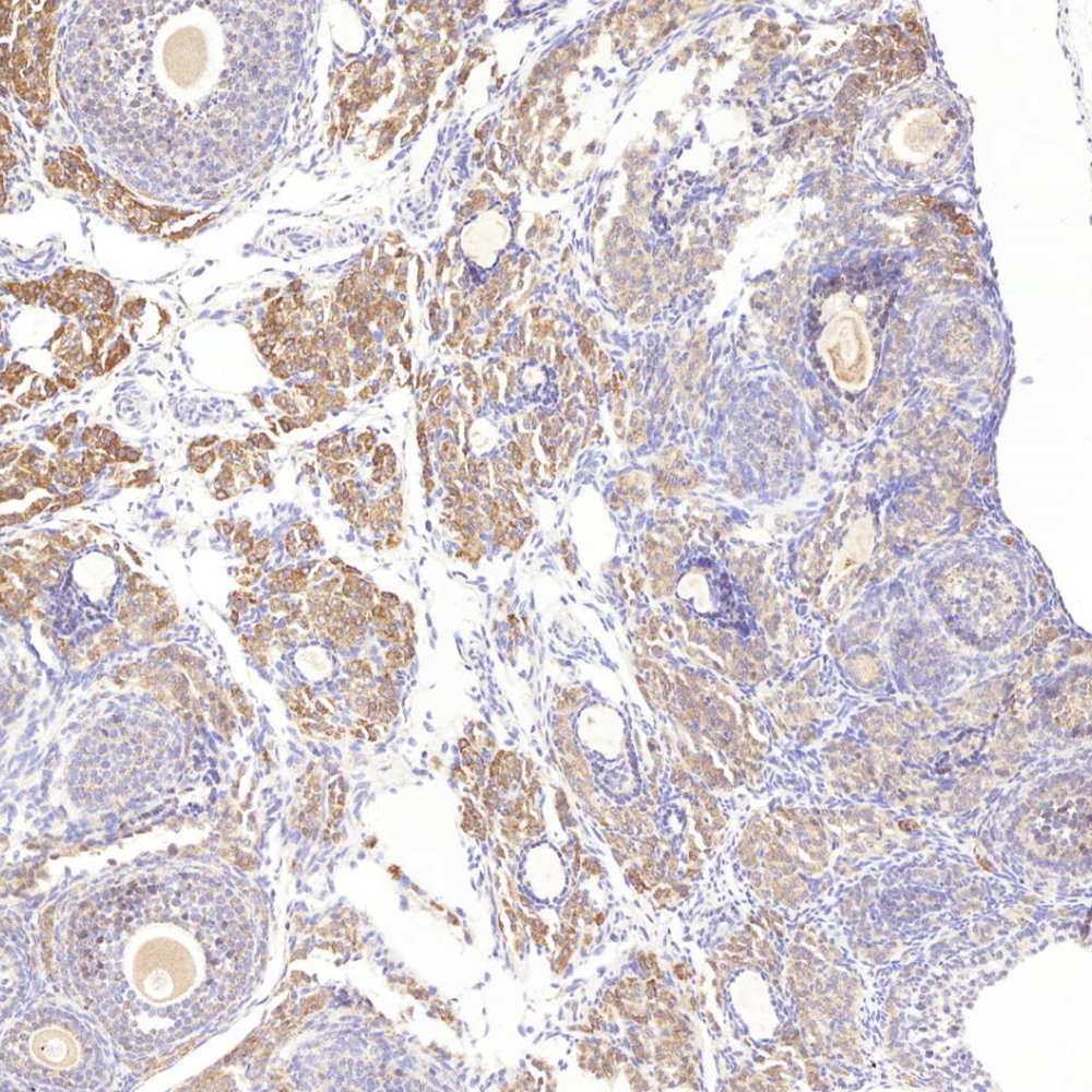 Immunohistochemistry analysis of paraffin-embedded mouse uterus  using MMP2 Polyclonal Antibody at dilution of 1:500.