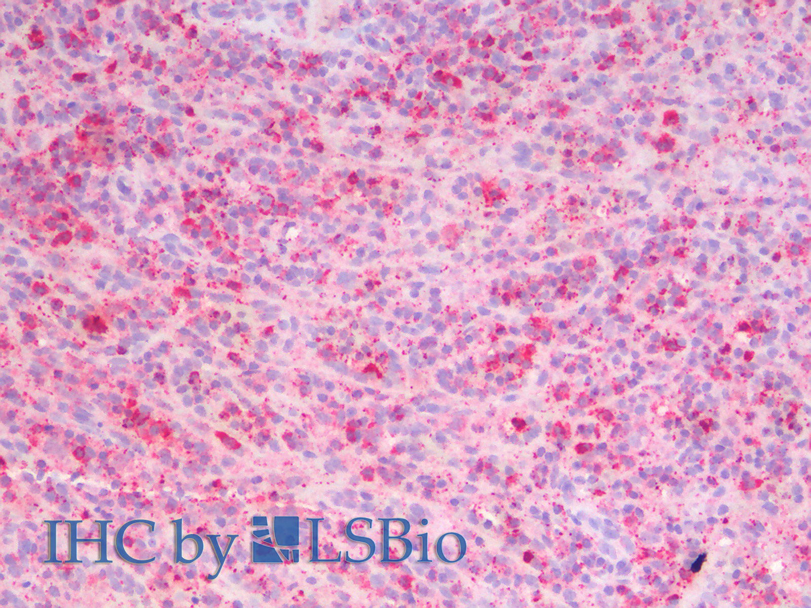 Immunohistochemistry analysis of paraffin-embedded Human Spleen using MMP2 Polyclonal Antibody.