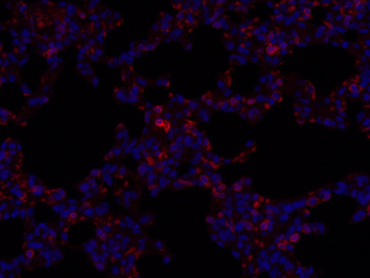 Immunofluorescence analysis of paraffin-embedded rat lung  using MMP9 Polyclonal Antibody at dilution of 1:100.