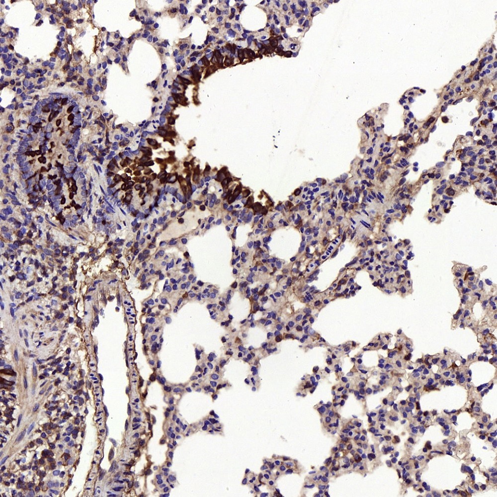 Immunohistochemistry analysis of paraffin-embedded rat lungs using MMP9 Polyclonal Antibody at dilution of 1:300.