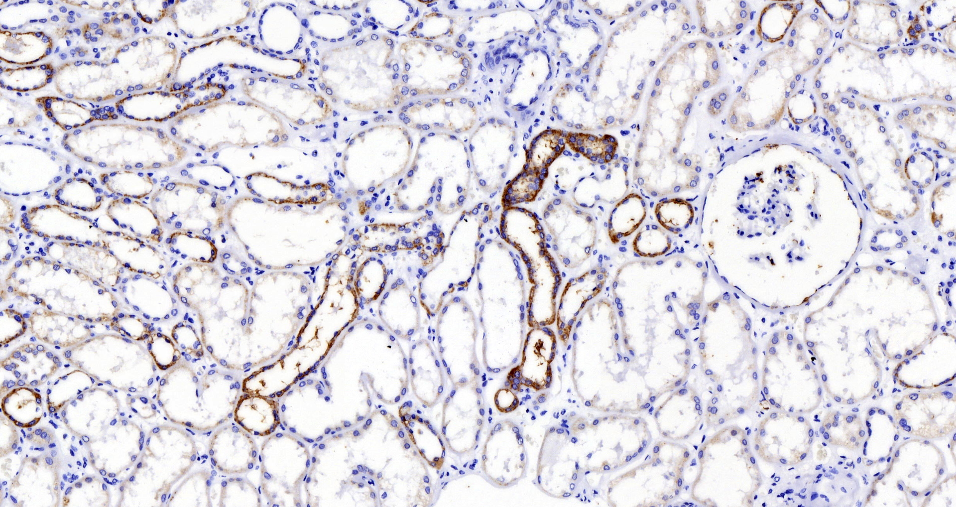 Immunohistochemistry analysis of paraffin-embedded human kidney  using MMP9 Polyclonal Antibody at dilution of 1:200.