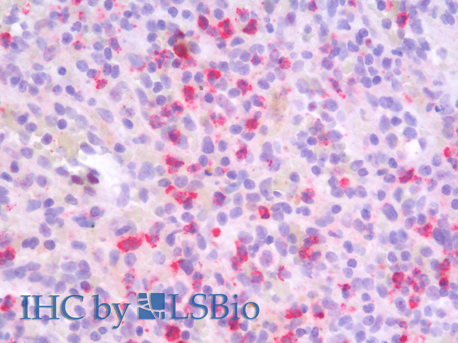 Immunohistochemistry analysis of paraffin-embedded Human Spleen using MMP9 Polyclonal Antibody.