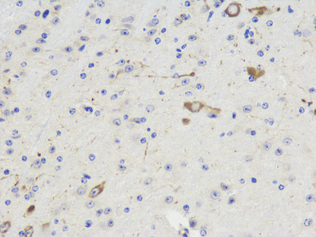 Immunohistochemistry analysis of paraffin-embedded Mouse brain  using NOS1 Polyclonal Antibody at dilution of 1:300.