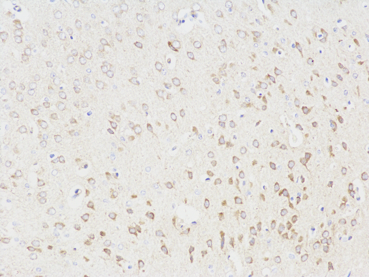 Immunohistochemistry analysis of paraffin-embedded Rat brain  using NOS1 Polyclonal Antibody at dilution of 1:300.