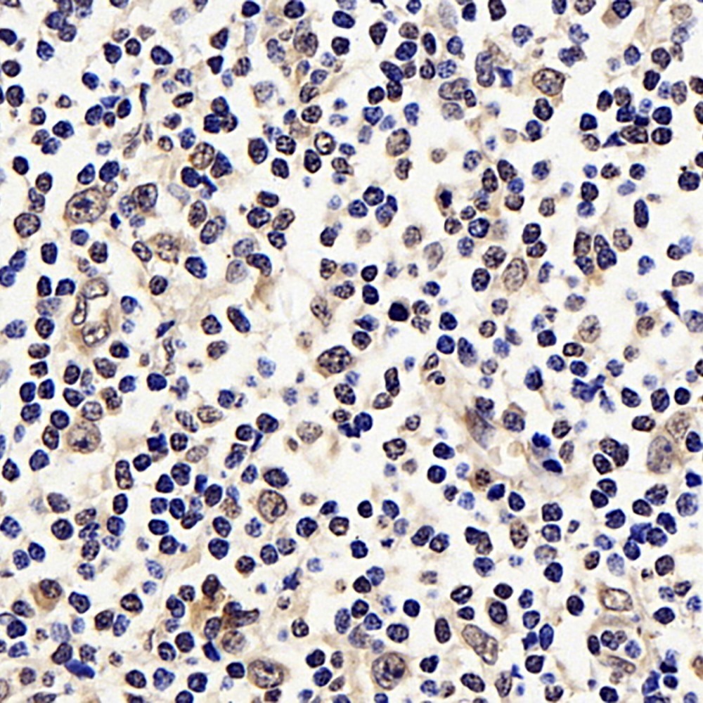 Immunohistochemistry analysis of paraffin-embedded Human tonsil  using p21 Polyclonal Antibody at dilution of 1:300.