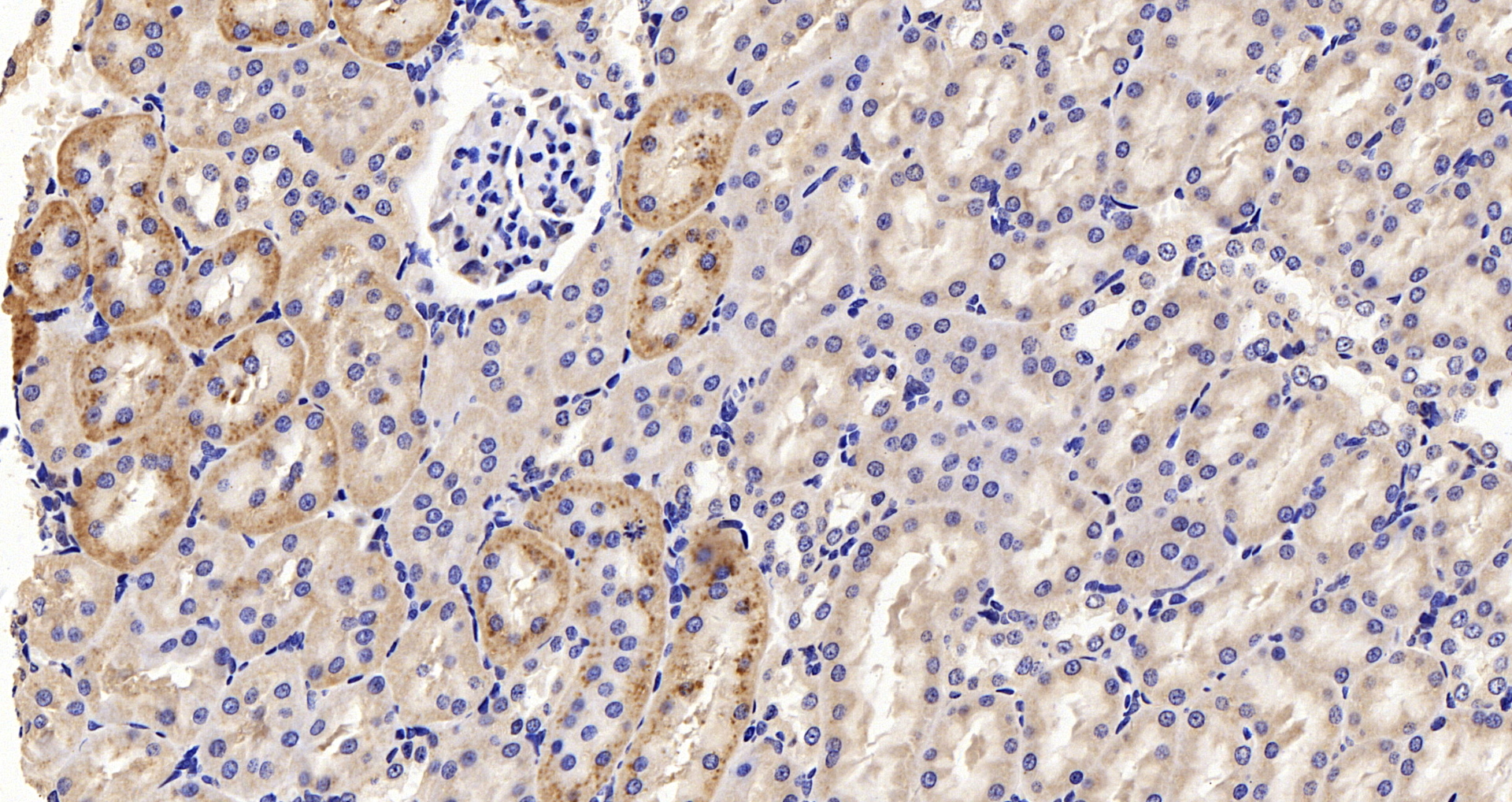 Immunohistochemistry analysis of paraffin-embedded Rat kidney using p21 Polyclonal Antibody at dilution of 1:300.