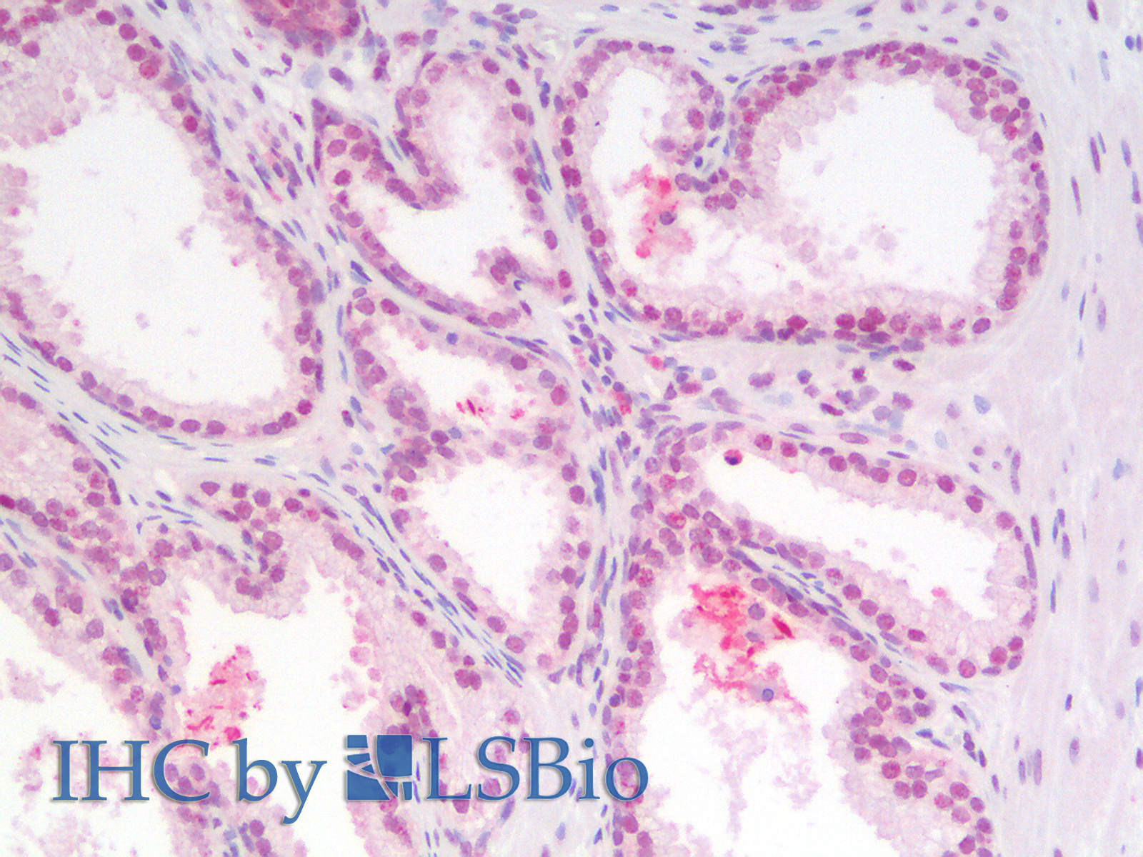 Immunohistochemistry analysis of paraffin-embedded Human Prostate using p27 Polyclonal Antibody.