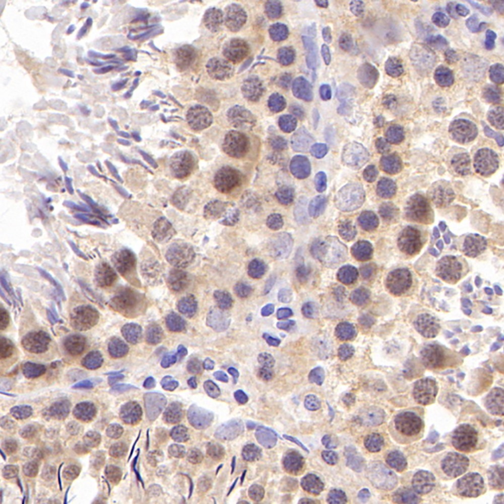 Immunohistochemistry analysis of paraffin-embedded Rat testis  using SIRT1 Polyclonal Antibody at dilution of 1:300.