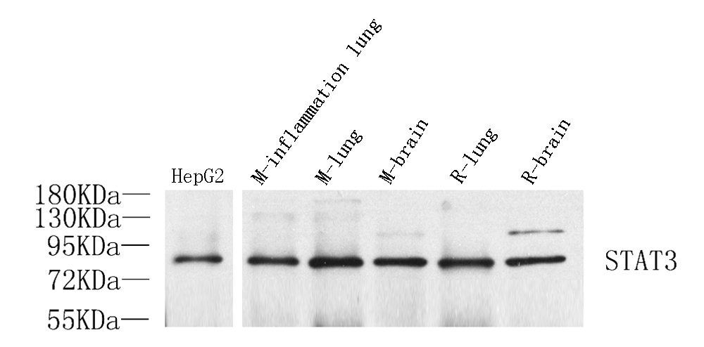 Western Blot analysis of various samples using STAT3 Polyclonal Antibody at dilution of 1:1000.