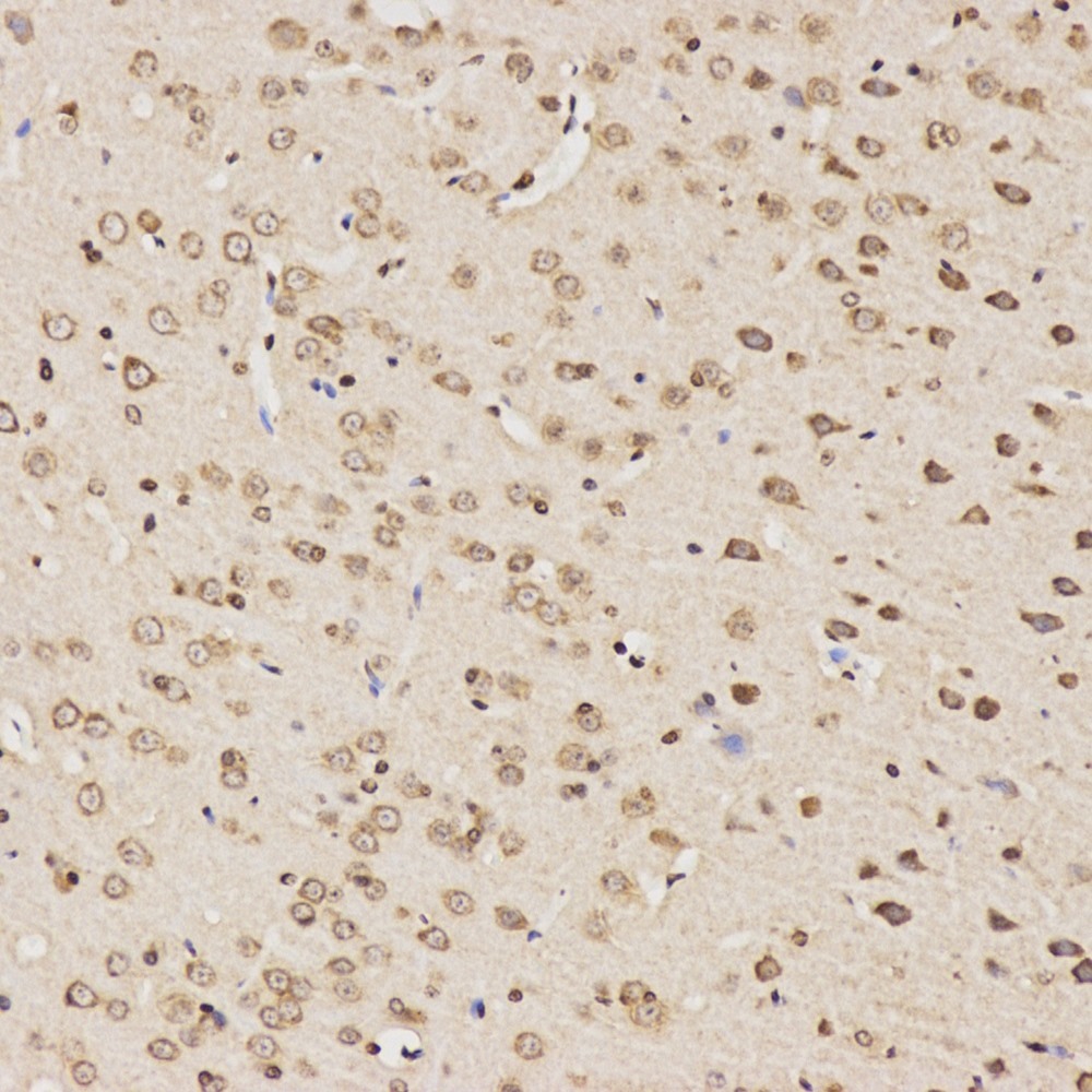 Immunohistochemistry analysis of paraffin-embedded rat brain  using Tau Polyclonal Antibody at dilution of 1:100.