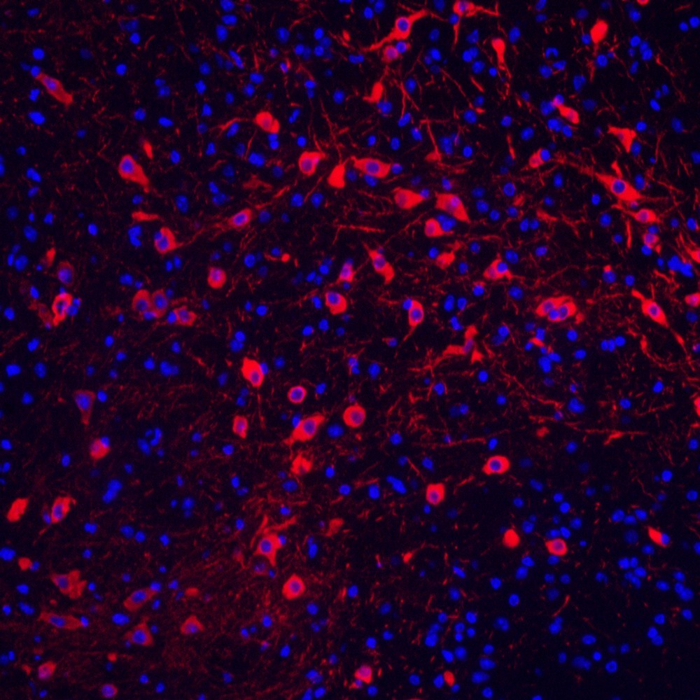 Immunofluorescence analysis of paraffin-embedded mouse brain  using TH Polyclonal Antibody at dilution of 1:300.