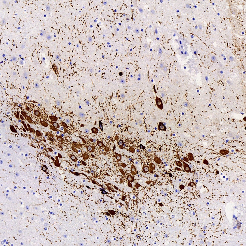 Immunohistochemistry analysis of paraffin-embedded Mouse brain striatum  using TH Polyclonal Antibody at dilution of 1:300.