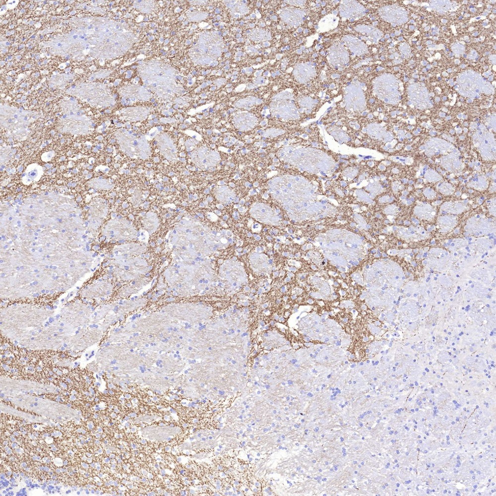 Immunohistochemistry analysis of paraffin-embedded Rat brain striatum  using TH Polyclonal Antibody at dilution of 1:300.