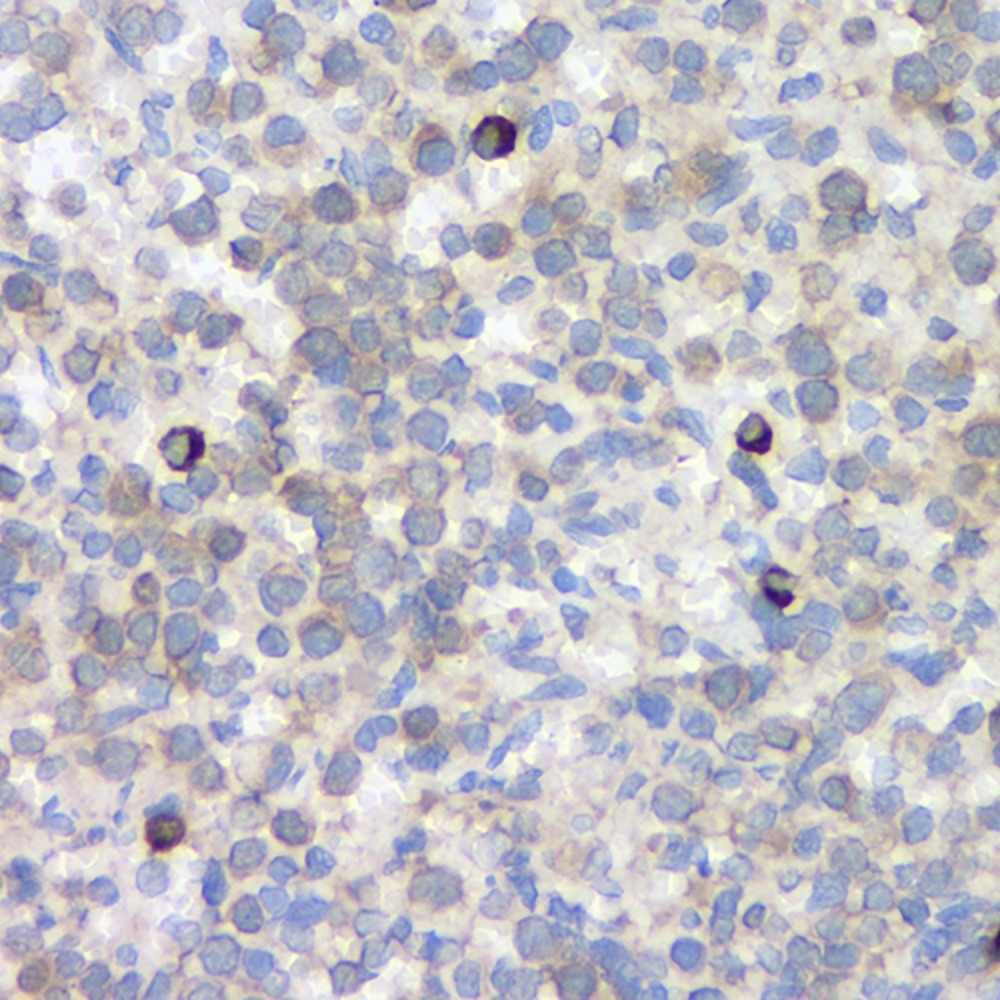 Immunohistochemistry analysis of paraffin-embedded rat spleen  using CD284 Polyclonal Antibody at dilution of 1:500.