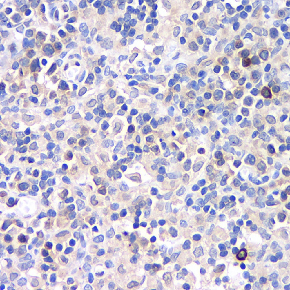 Immunohistochemistry analysis of paraffin-embedded rat lymph node  using CD284 Polyclonal Antibody at dilution of 1:500.