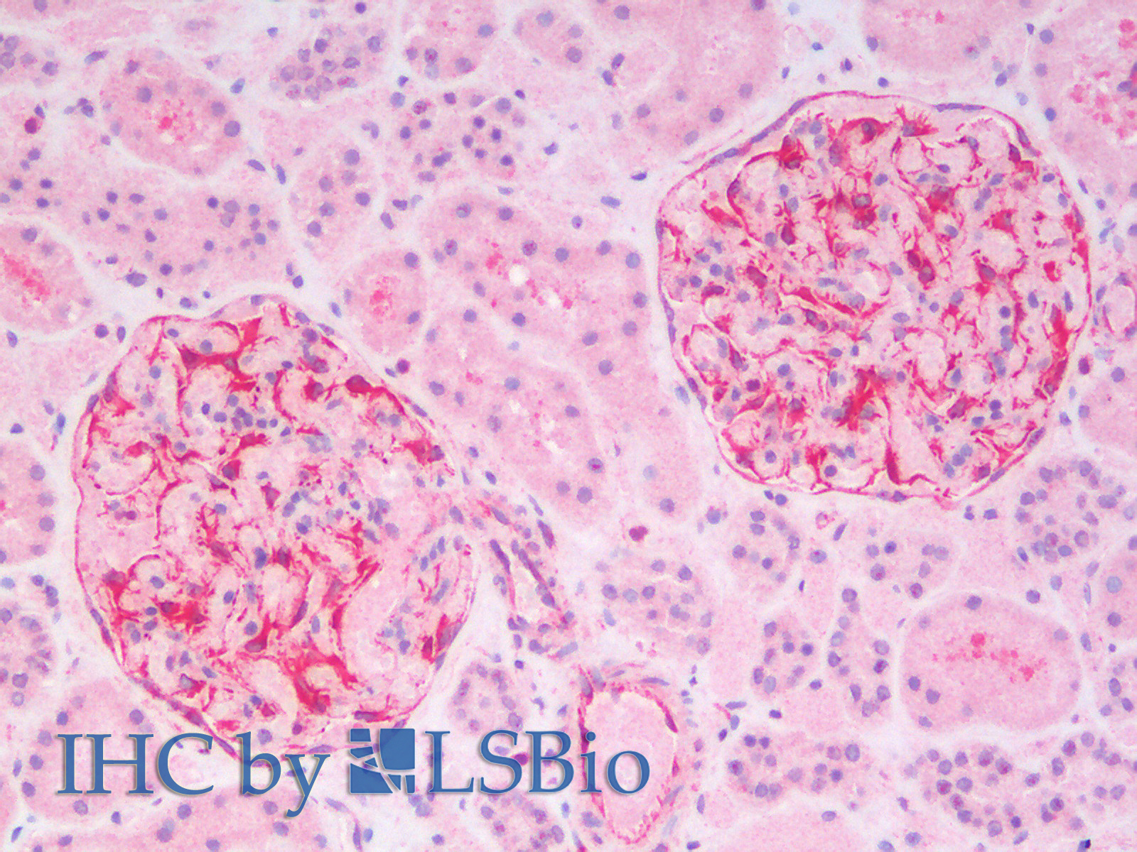 Immunohistochemistry analysis of paraffin-embedded Human Kidney using Vimentin Polyclonal Antibody.