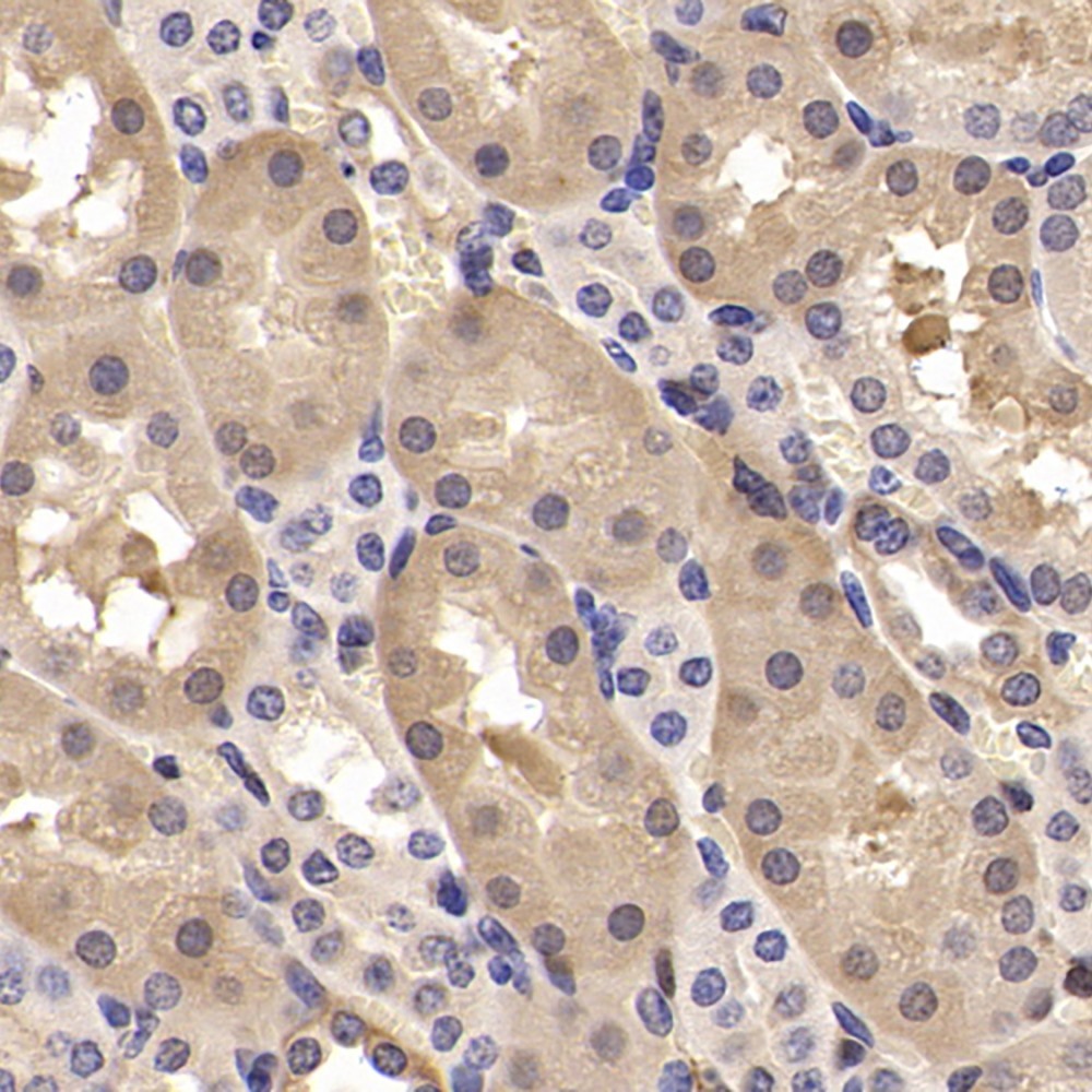 Immunohistochemistry analysis of paraffin-embedded mouse kidney  using CK-19 Polyclonal Antibody at dilution of 1:300.