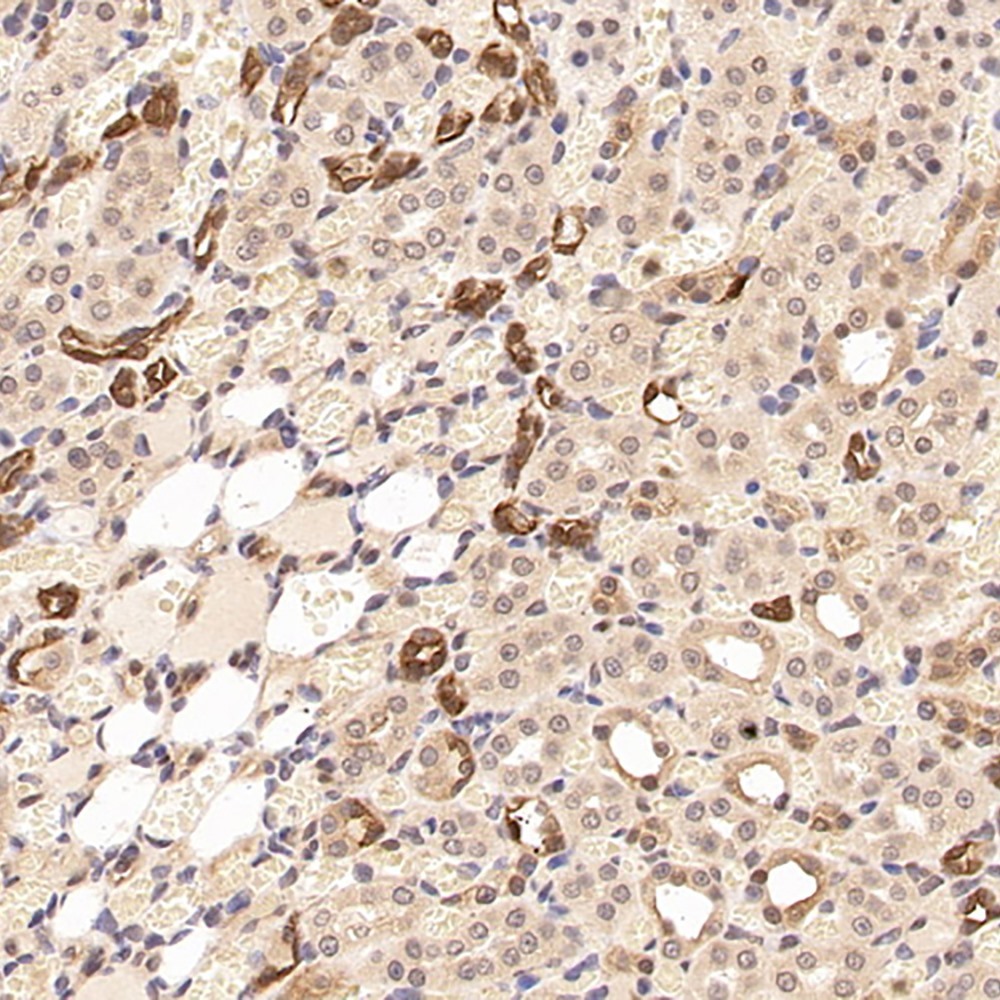 Immunohistochemistry analysis of paraffin-embedded rat kidney  using CK-19 Polyclonal Antibody at dilution of 1:300.