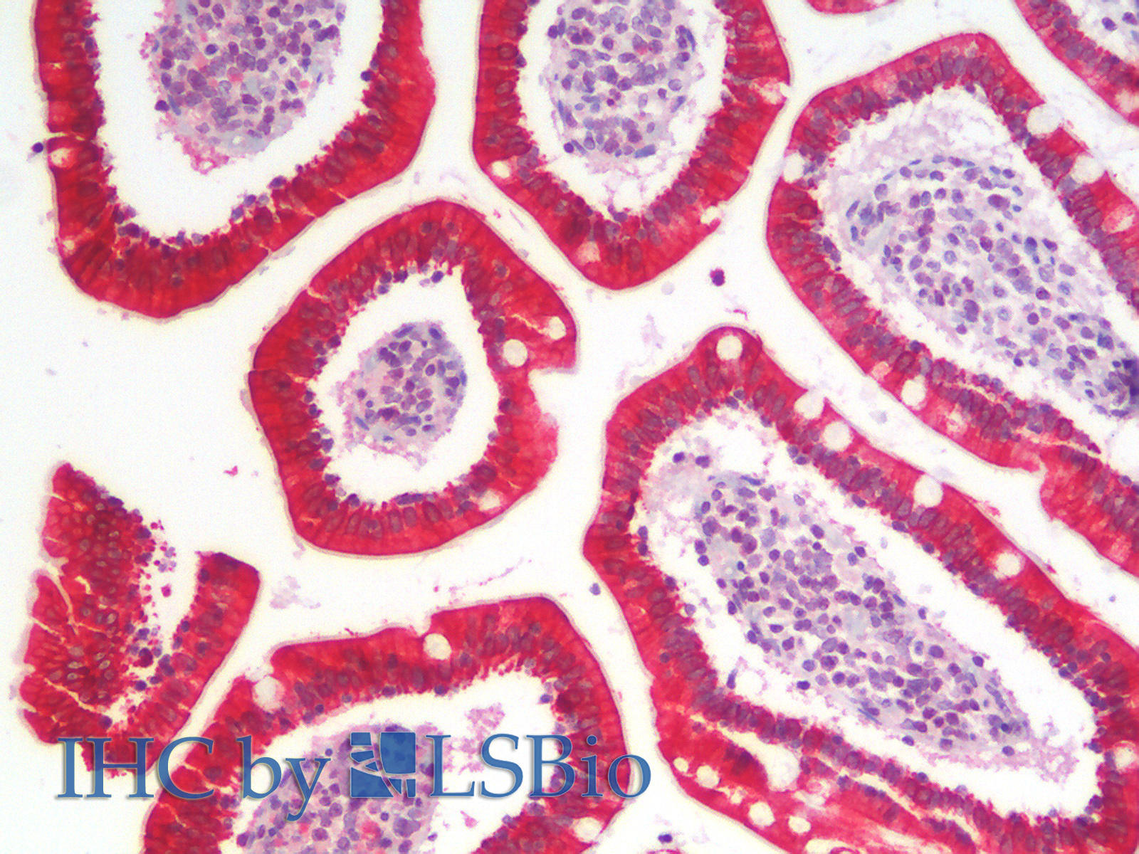 Immunohistochemistry analysis of paraffin-embedded Human SmallIntestine using CK-19 Polyclonal Antibody.