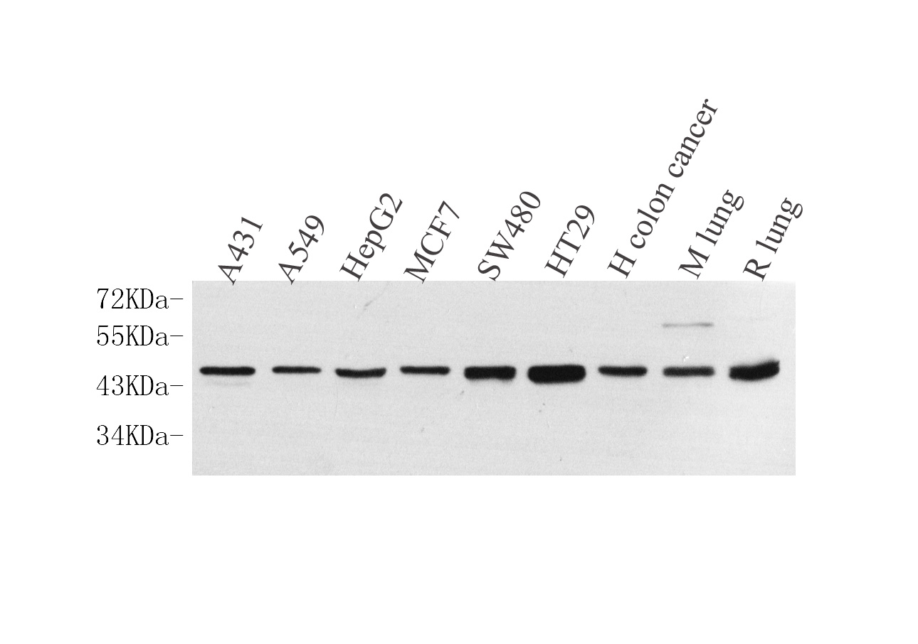 Western Blot analysis of various samples using CK-19 Polyclonal Antibody at dilution of 1:1000.