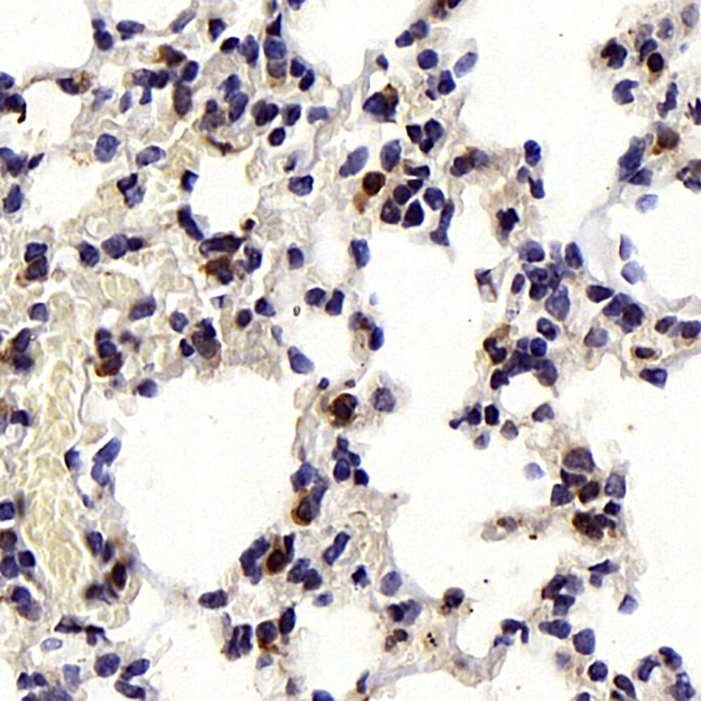 Immunohistochemistry analysis of paraffin-embedded mouse lung  using BAD Polyclonal Antibody at dilution of 1:300.