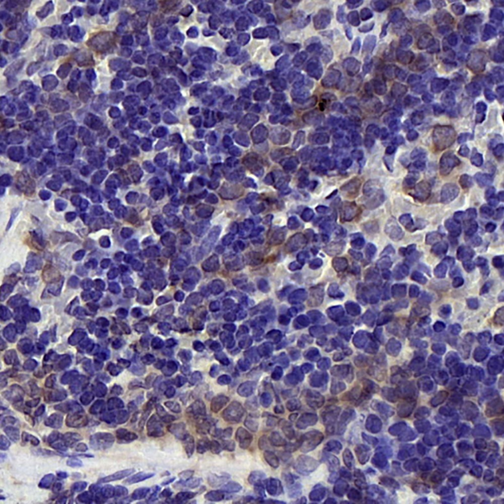 Immunohistochemistry analysis of paraffin-embedded rat spleen  using BAD Polyclonal Antibody at dilution of 1:300.