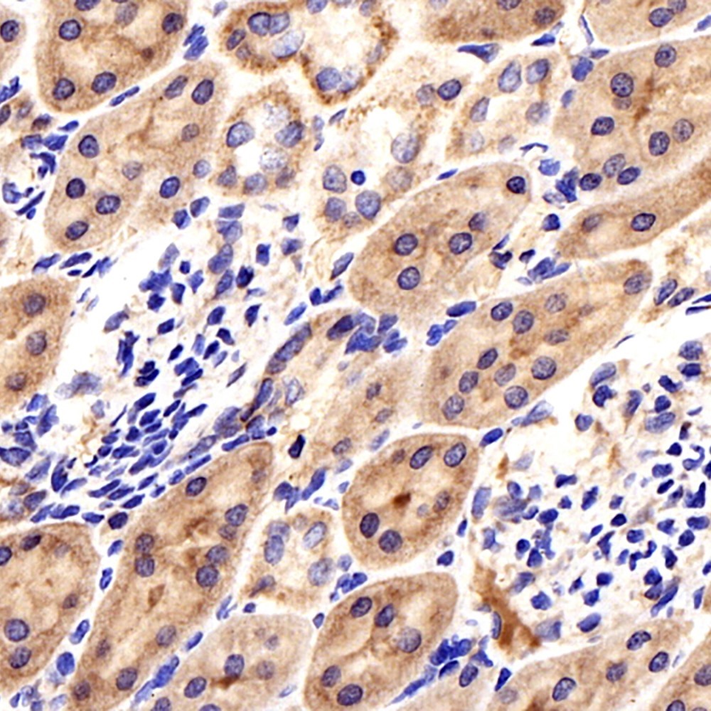 Immunohistochemistry analysis of paraffin-embedded mouse kidney  using CCL2 Polyclonal Antibody at dilution of 1:300.