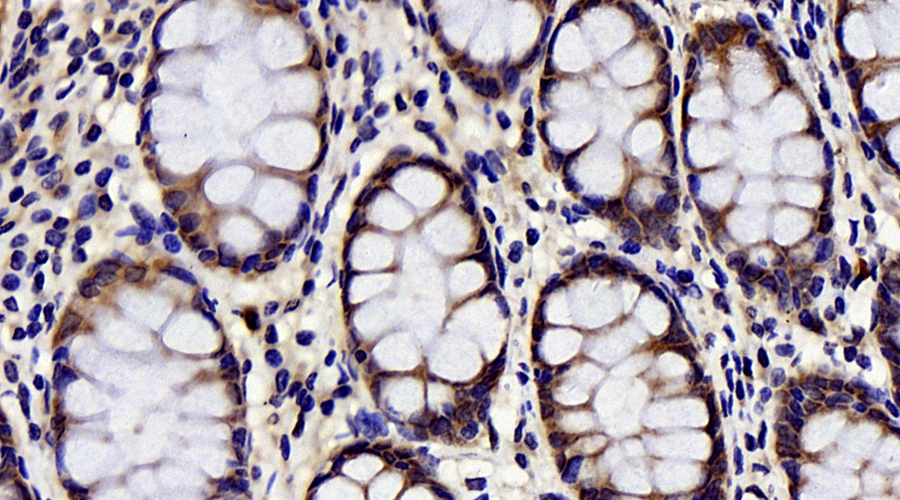 Immunohistochemistry analysis of paraffin-embedded human colon  using CHOP Polyclonal Antibody at dilution of 1:300.