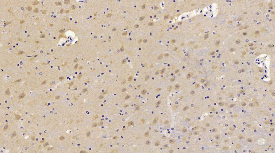 Immunohistochemistry analysis of paraffin-embedded Rat brain  using CHOP Polyclonal Antibody at dilution of 1:300.
