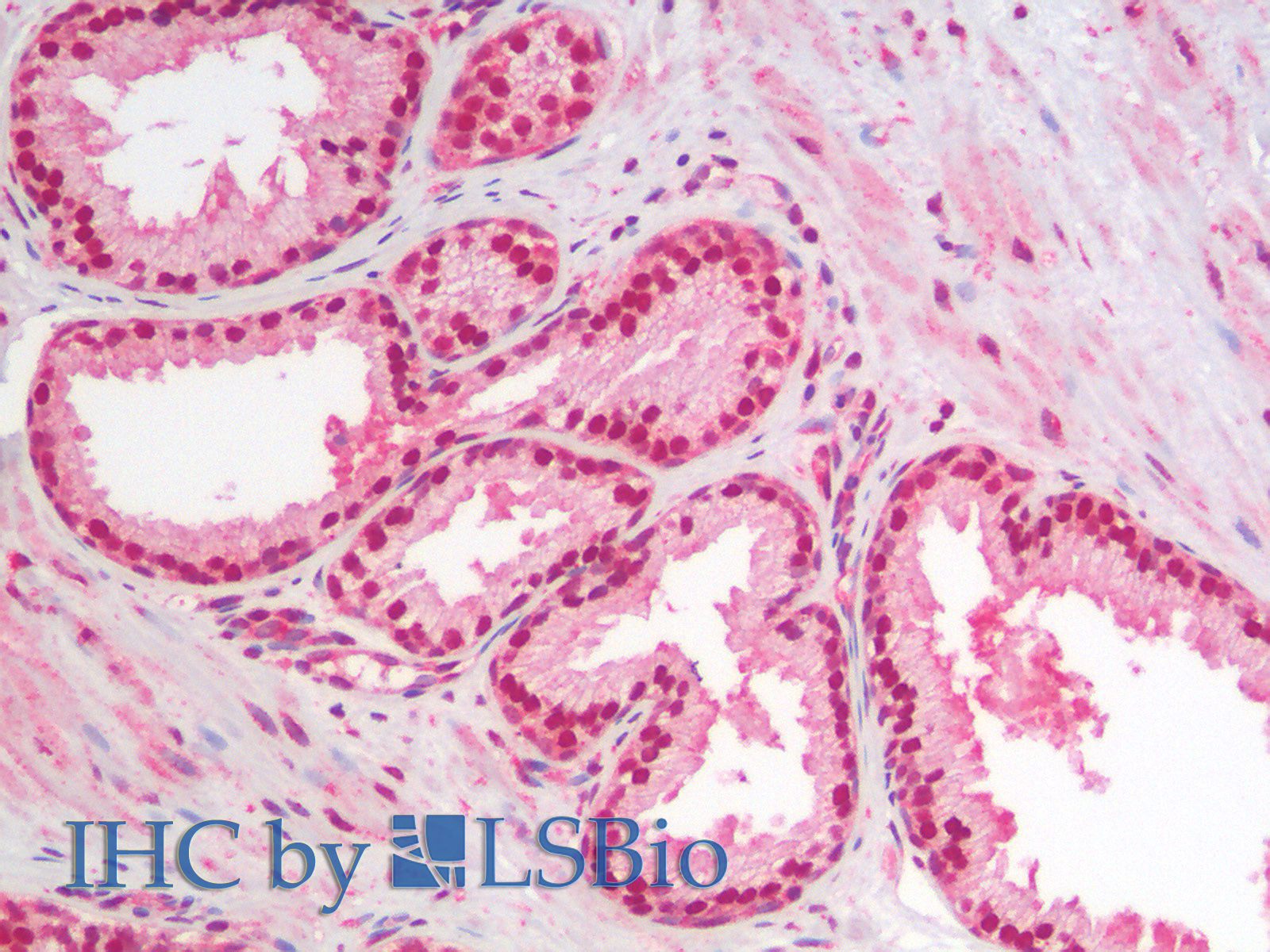 Immunohistochemistry analysis of paraffin-embedded Human Prostate using IkB alpha Polyclonal Antibody.