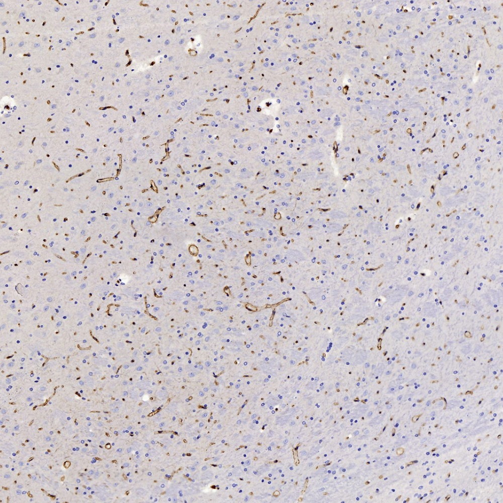 Immunohistochemistry analysis of paraffin-embedded Rat brain  using GLUT-1 Polyclonal Antibody at dilution of 1:300.