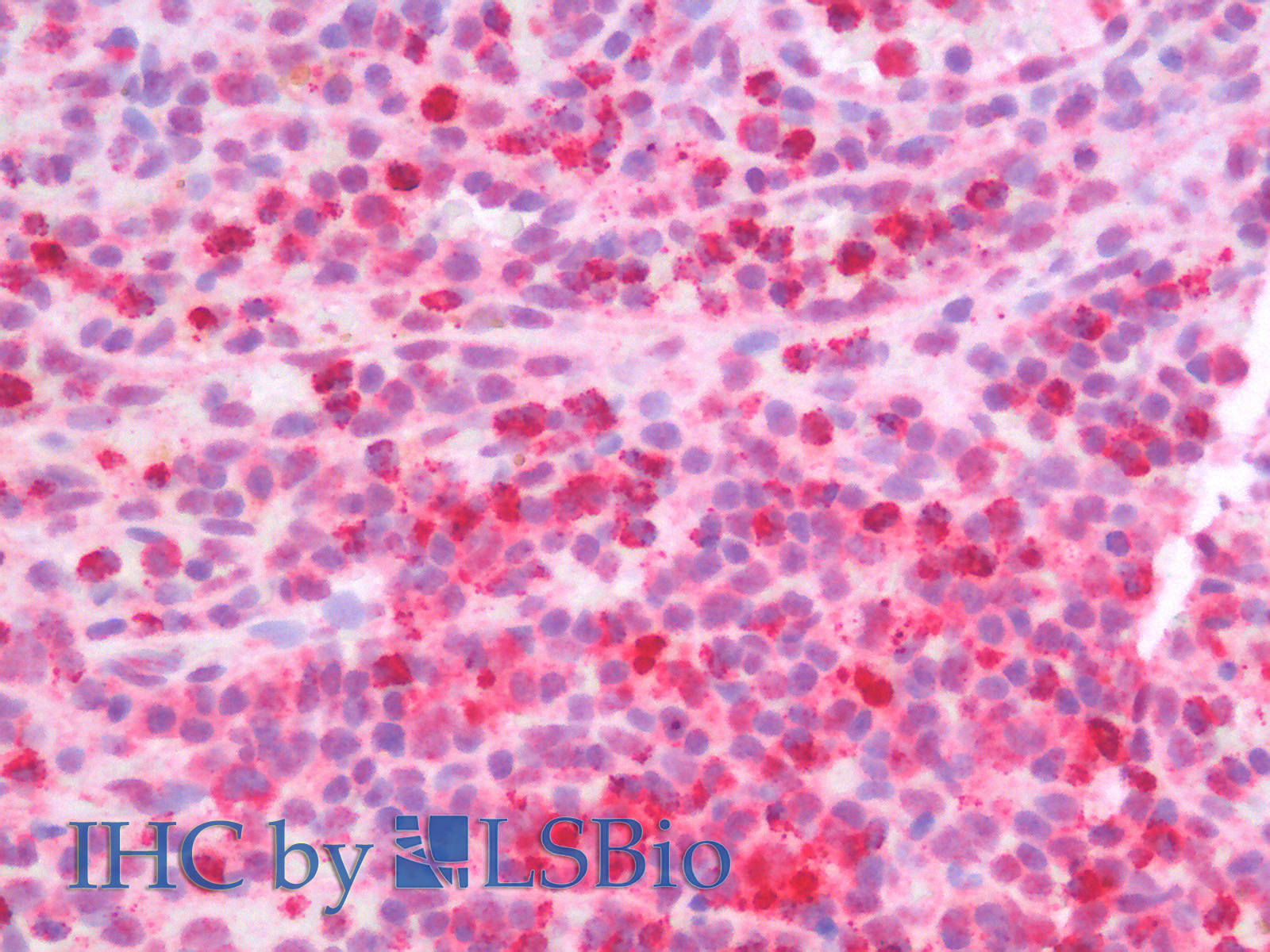 Immunohistochemistry analysis of paraffin-embedded Human Spleen using MPO Polyclonal Antibody.