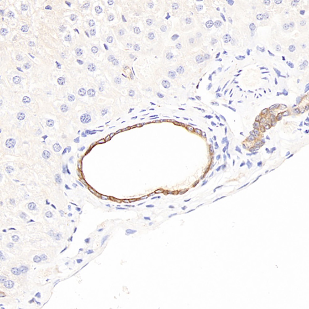 Immunohistochemistry analysis of paraffin-embedded mouse liver  using CK-7 Polyclonal Antibody at dilution of 1:300.