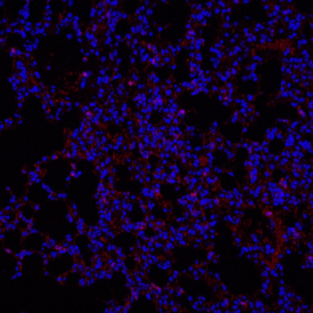 Immunofluorescence analysis of paraffin-embedded mouse Inflammatory lung  using Ly6g Polyclonal Antibody at dilution of 1:200.