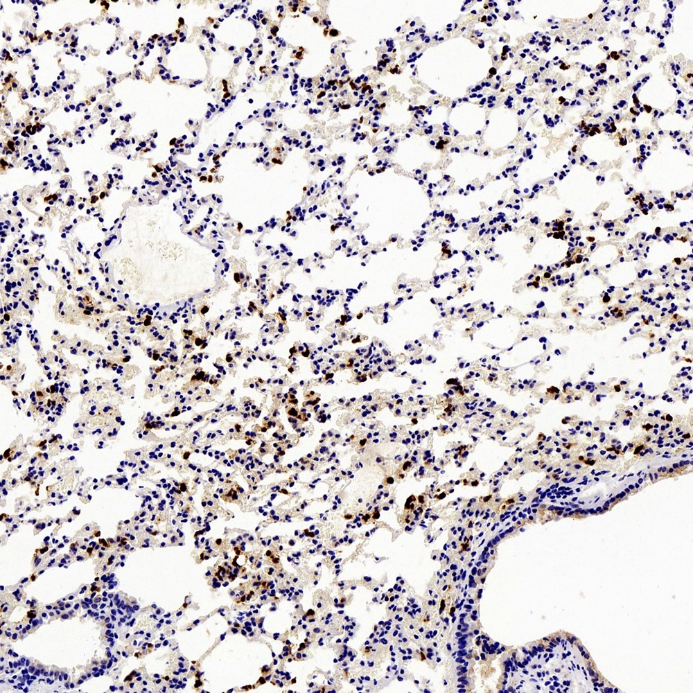 Immunohistochemistry analysis of paraffin-embedded mouse Inflammatory lung  using Ly6g Polyclonal Antibody at dilution of 1:200.