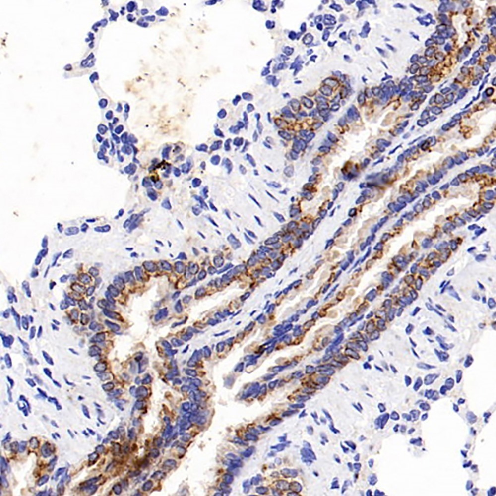 Immunohistochemistry analysis of paraffin-embedded Rat lung  using CK-18 Polyclonal Antibody at dilution of 1:500.