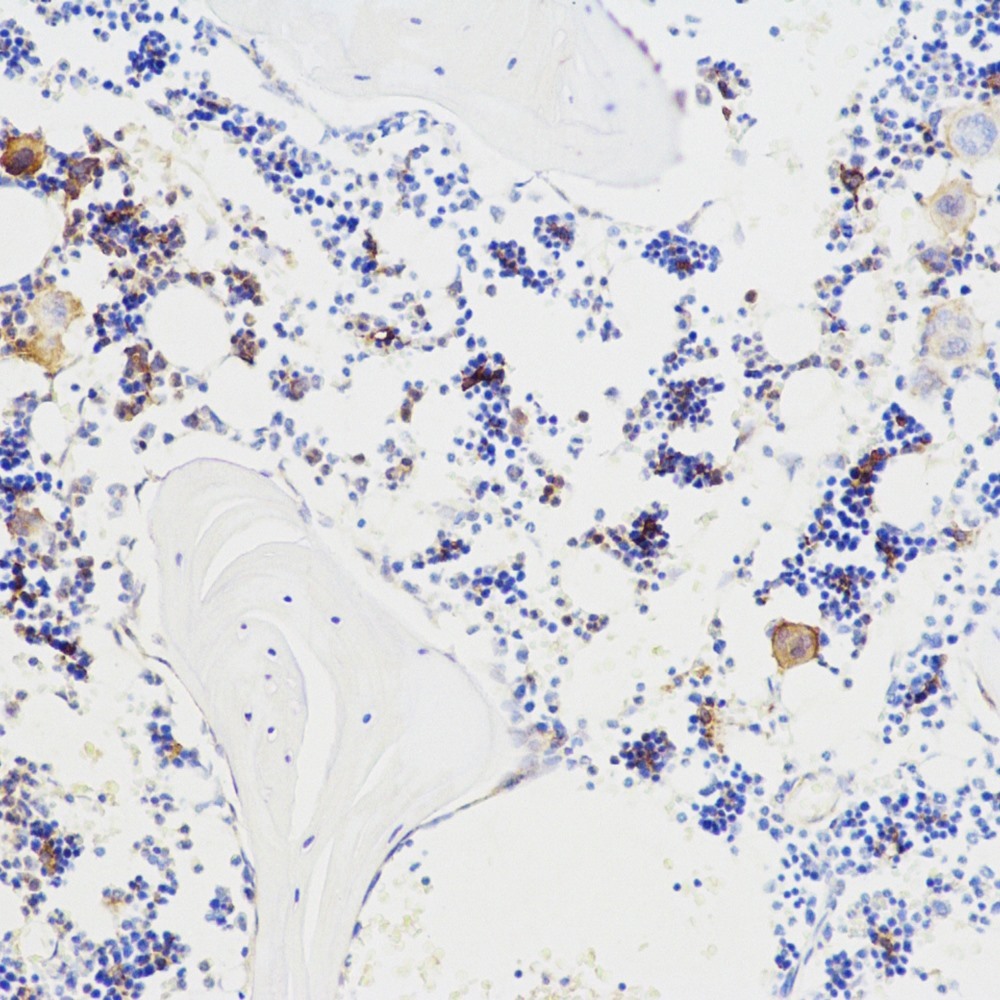 Immunohistochemistry analysis of paraffin-embedded mouse bone  using BGLAP Polyclonal Antibody at dilution of 1:100.