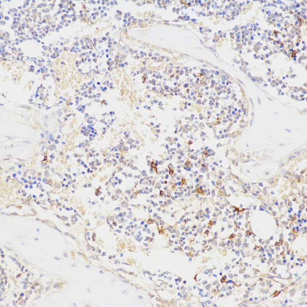 Immunohistochemistry analysis of paraffin-embedded rat bone  using BGLAP Polyclonal Antibody at dilution of 1:100.