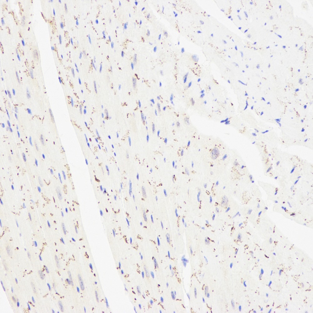 Immunohistochemistry analysis of paraffin-embedded mouse heart  using Connexin 43 Polyclonal Antibody at dilution of 1:300.