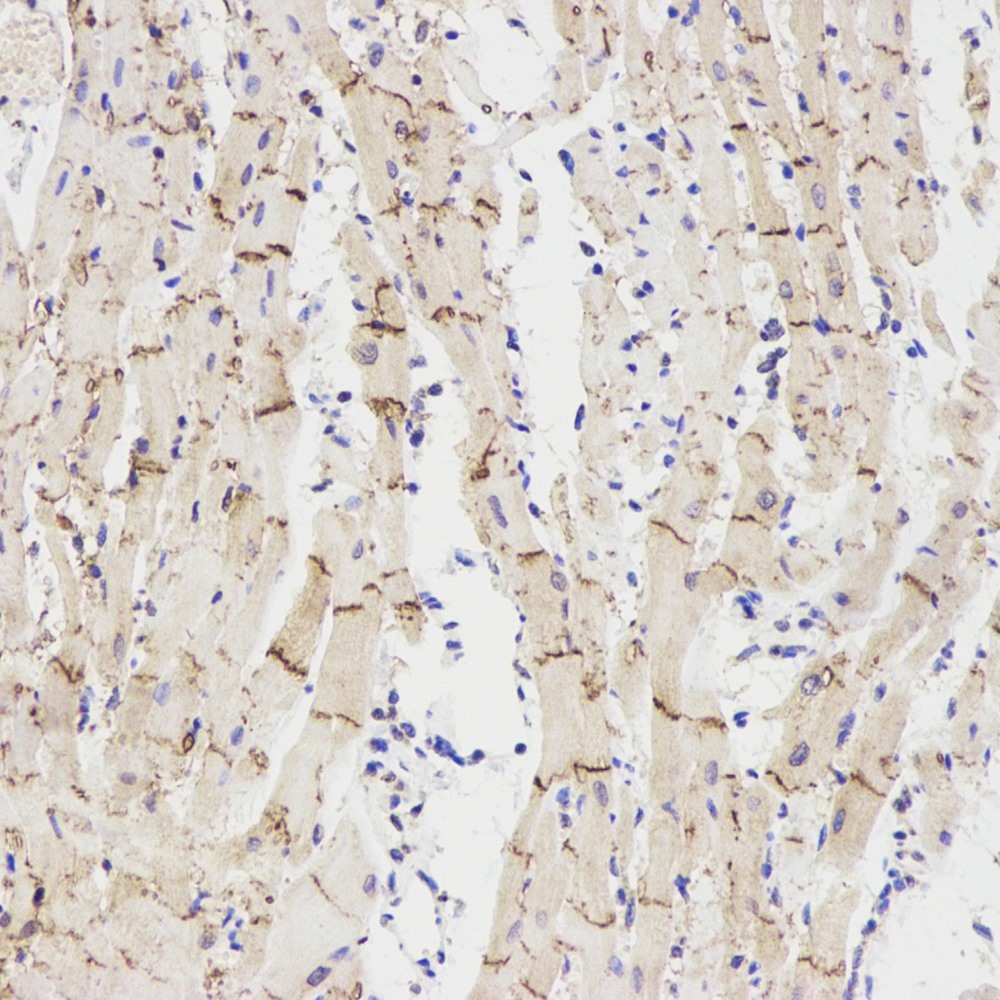 Immunohistochemistry analysis of paraffin-embedded rat heart  using Connexin 43 Polyclonal Antibody at dilution of 1:300.