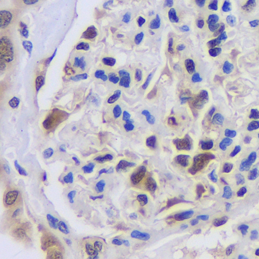 Immunohistochemistry analysis of paraffin-embedded human kidney   using CREB1 Polyclonal Antibody at dilution of 1:200.